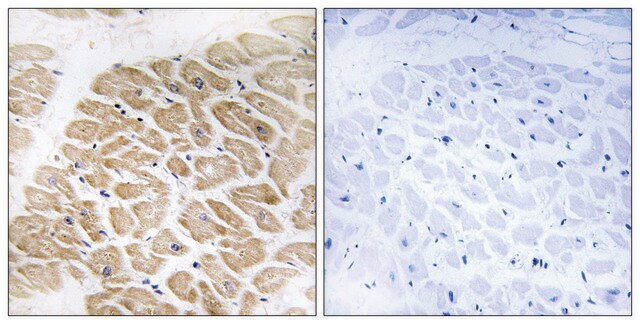 Anti-MIA, C-Terminal antibody produced in rabbit affinity isolated antibody