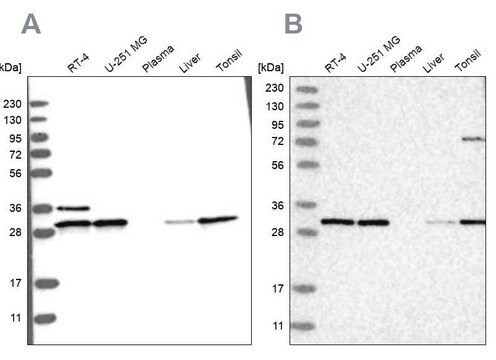 Anti-RPA2 antibody produced in rabbit Prestige Antibodies&#174; Powered by Atlas Antibodies, affinity isolated antibody, buffered aqueous glycerol solution, ab1