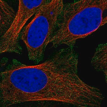 Anti-Sdc2 Antibody Produced In Rabbit Prestige Antibodies&#174; Powered by Atlas Antibodies, affinity isolated antibody, buffered aqueous glycerol solution