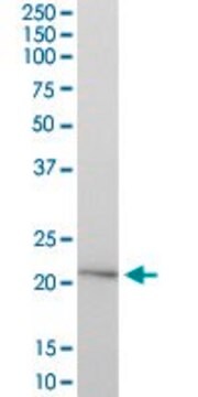 Anti-HYAL1 antibody produced in mouse purified immunoglobulin, buffered aqueous solution