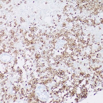 Anti-CD79a antibody produced in rabbit