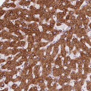 Anti-DISP3 antibody produced in rabbit Prestige Antibodies&#174; Powered by Atlas Antibodies, affinity isolated antibody, buffered aqueous glycerol solution