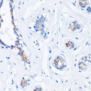 Anti-HRAS antibody produced in rabbit