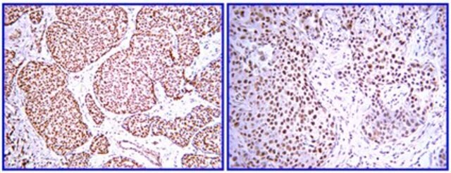 Anti-PDGF-BB Antibody from rabbit, purified by affinity chromatography