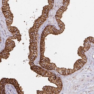 Anti-CAST antibody produced in rabbit Prestige Antibodies&#174; Powered by Atlas Antibodies, affinity isolated antibody, buffered aqueous glycerol solution