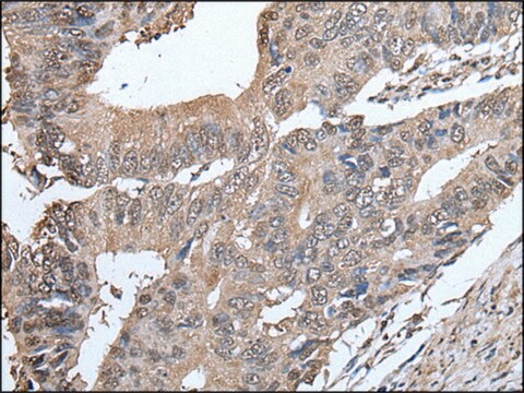 Anti-SMC5 affinity isolated antibody