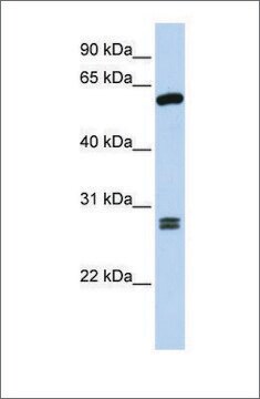 Anti-ACD antibody produced in rabbit affinity isolated antibody