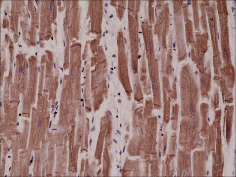 Anti-Desmin antibody, Rabbit monoclonal recombinant, expressed in HEK 293 cells, clone RM234, purified immunoglobulin