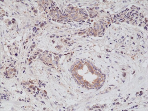 Anti-EGF Receptor antibody, Rabbit Monoclonal recombinant, expressed in HEK 293 cells, clone RM294, purified immunoglobulin