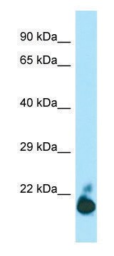 Anti-TIGIT (C-terminal) antibody produced in rabbit affinity isolated antibody