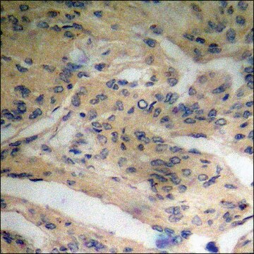 Anti-phospho-Shc (pTyr427) antibody produced in rabbit affinity isolated antibody