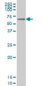 ANTI-GRK6 antibody produced in mouse clone 8B7, purified immunoglobulin, buffered aqueous solution