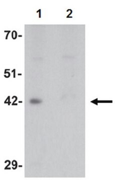 Anti-DPAGT1 Antibody from rabbit, purified by affinity chromatography