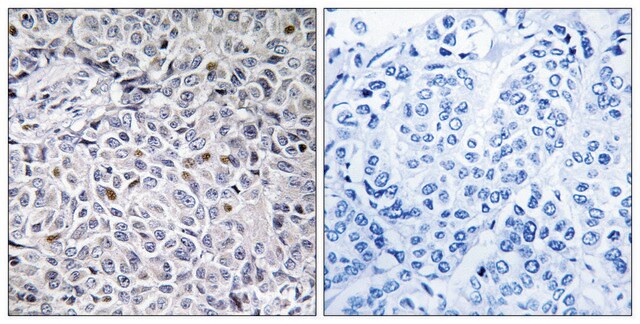 Anti-ZAP-70 antibody produced in rabbit affinity isolated antibody