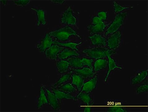 Monoclonal Anti-CDK4 antibody produced in mouse clone 4F11, purified immunoglobulin, buffered aqueous solution