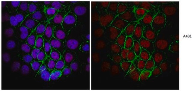 Anti-Replication Protein A Antibody, clone RPA34-19 clone RPA34-19, from mouse