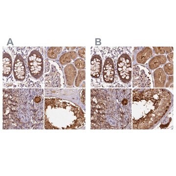 Anti-ST13 antibody produced in rabbit Prestige Antibodies&#174; Powered by Atlas Antibodies, affinity isolated antibody, buffered aqueous glycerol solution