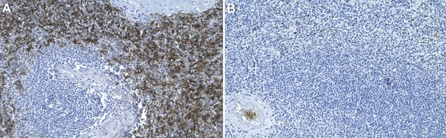 Anti-CD16a Antibody, clone 1E6 ZooMAb&#174; Rabbit Monoclonal recombinant, expressed in HEK 293 cells