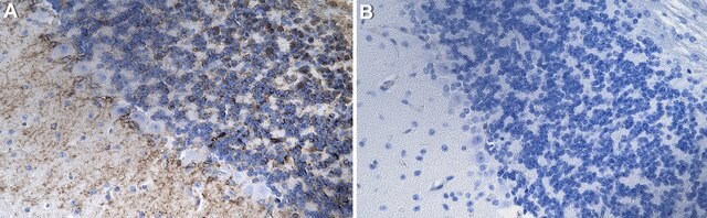 Anti-Glucuronoxylomannan/GXM Antibody, clone 3E5