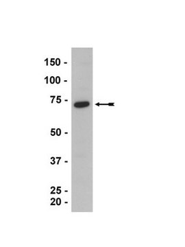 Anti-HRI Antibody serum, Upstate&#174;