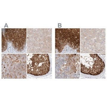 Anti-PGD antibody produced in rabbit Prestige Antibodies&#174; Powered by Atlas Antibodies, affinity isolated antibody, buffered aqueous glycerol solution