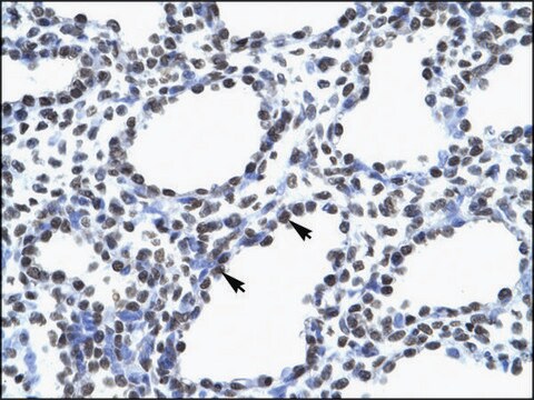 Anti-MyEF2 antibody produced in rabbit affinity isolated antibody