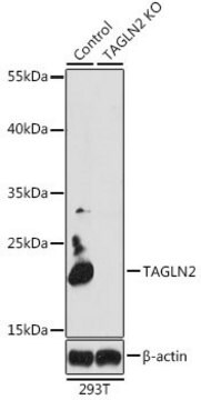 Anti-TAGLN2 antibody produced in rabbit