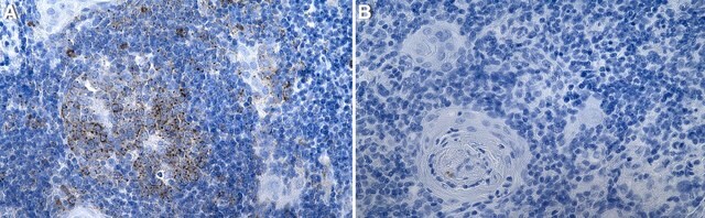 Anti-MX1/MxA Antibody, clone 2C20 ZooMAb&#174; Rabbit Monoclonal recombinant, expressed in HEK 293 cells