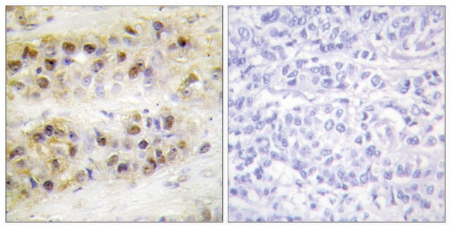 Anti-RORA, N-Terminal antibody produced in rabbit affinity isolated antibody