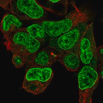 Anti-CPD antibody produced in rabbit Prestige Antibodies&#174; Powered by Atlas Antibodies, affinity isolated antibody