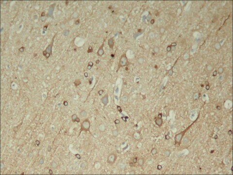 Anti-phospho-MAPT (pSer396) antibody produced in rabbit affinity isolated antibody