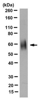 Anti-LTP/CETP Antibody, clone 14&#8211;8F clone 14-8F, from mouse