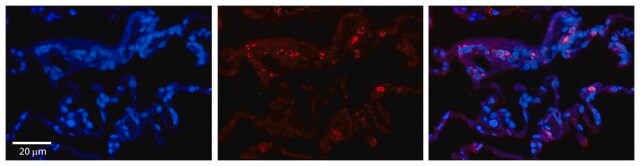 Anti-BCKDHA, (N-terminal) antibody produced in rabbit affinity isolated antibody