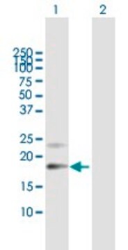 Anti-PTGDS antibody produced in mouse purified immunoglobulin, buffered aqueous solution