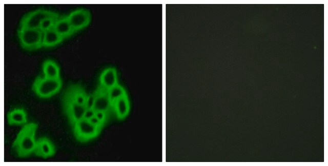 Anti-FPR1 antibody produced in rabbit affinity isolated antibody