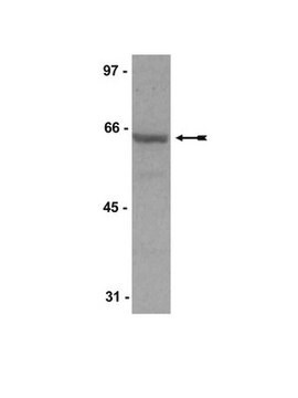 Anti-SHP-1/SHPTP-1 Antibody Upstate&#174;, from rabbit