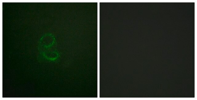 Anti-IL-4R antibody produced in rabbit affinity isolated antibody