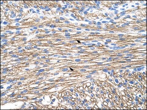 Anti-MBNL1 (AB1) antibody produced in rabbit affinity isolated antibody