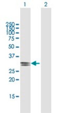 Anti-ECHDC2 antibody produced in mouse purified immunoglobulin, buffered aqueous solution