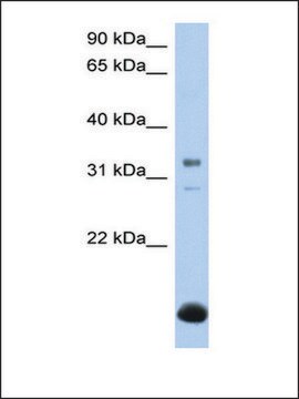 Anti-B3GALT6 (AB1) antibody produced in rabbit affinity isolated antibody