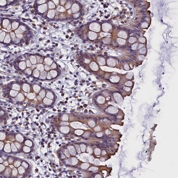 Anti-STK32A antibody produced in rabbit Prestige Antibodies&#174; Powered by Atlas Antibodies, affinity isolated antibody, buffered aqueous glycerol solution