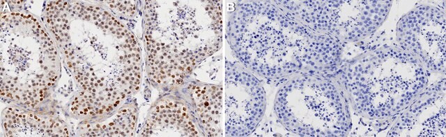 Anti-CDK9 Antibody, clone 1F9 ZooMAb&#174; Rabbit Monoclonal recombinant, expressed in HEK 293 cells