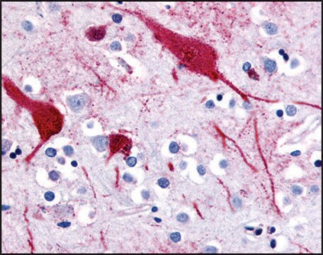 Anti-SLC5A9 (AB2) antibody produced in rabbit affinity isolated antibody, buffered aqueous solution