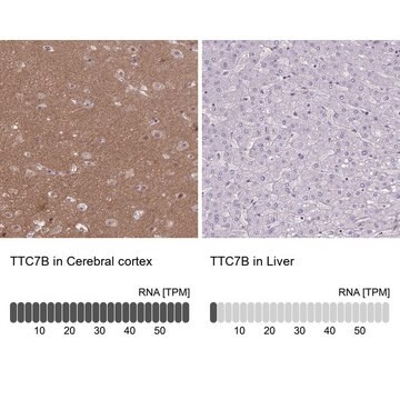 Anti-TTC7B antibody produced in rabbit Prestige Antibodies&#174; Powered by Atlas Antibodies, affinity isolated antibody, buffered aqueous glycerol solution