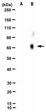 Anti-HCV E2 Antibody, clone AP33