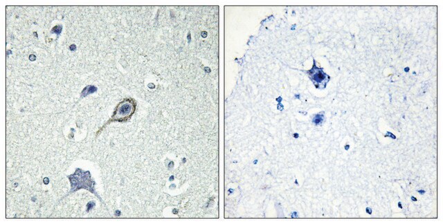 Anti-CNR1 antibody produced in rabbit affinity isolated antibody