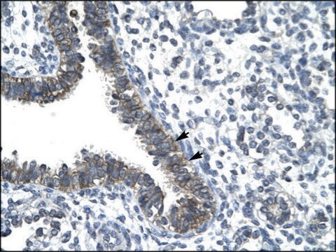 Anti-CCRN4L antibody produced in rabbit IgG fraction of antiserum