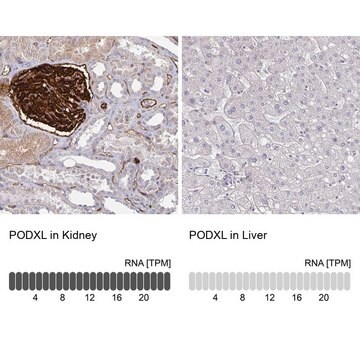 Anti-PODXL antibody produced in rabbit Prestige Antibodies&#174; Powered by Atlas Antibodies, affinity isolated antibody, buffered aqueous glycerol solution