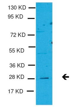 Anti-TGIF2 Antibody Upstate&#174;, from rabbit