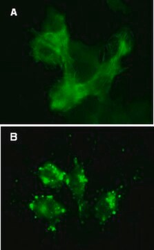 LentiBrite GFP-&#946;-actin Lentiviral Biosensor